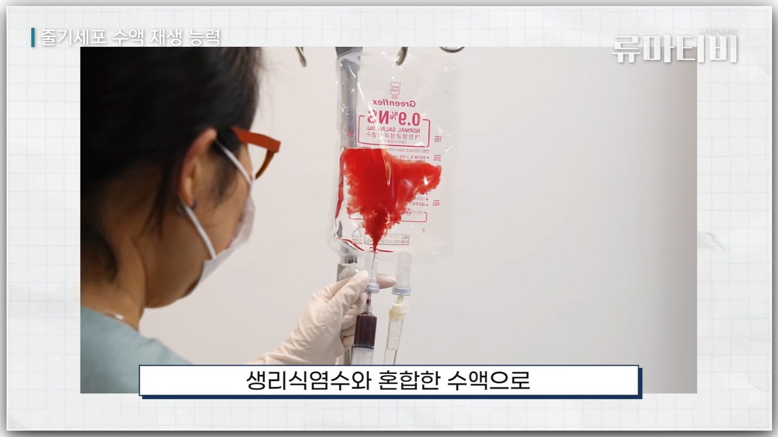 줄기세포 수액팩