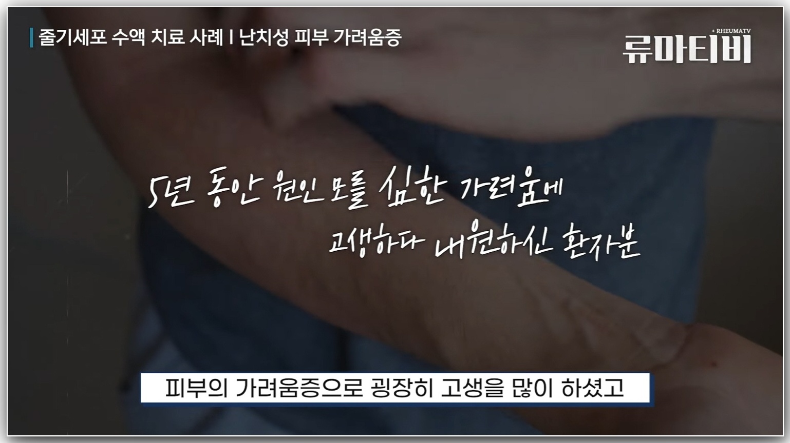 심한 피부 가려움 사례