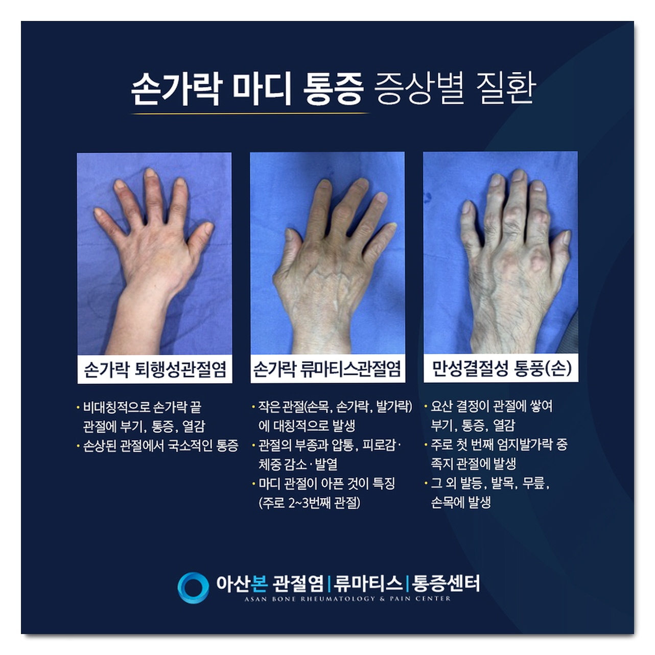 손가락 마디 통증 - 퇴행성 관절염과 류마티스 관절염 비교, 손가락 끝 통증