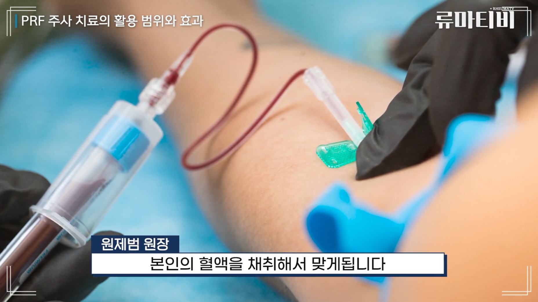 무릎 아플때 고려할 수 있는 PRF 주사는 자가혈 기반의 치료로 비교적 안전합니다