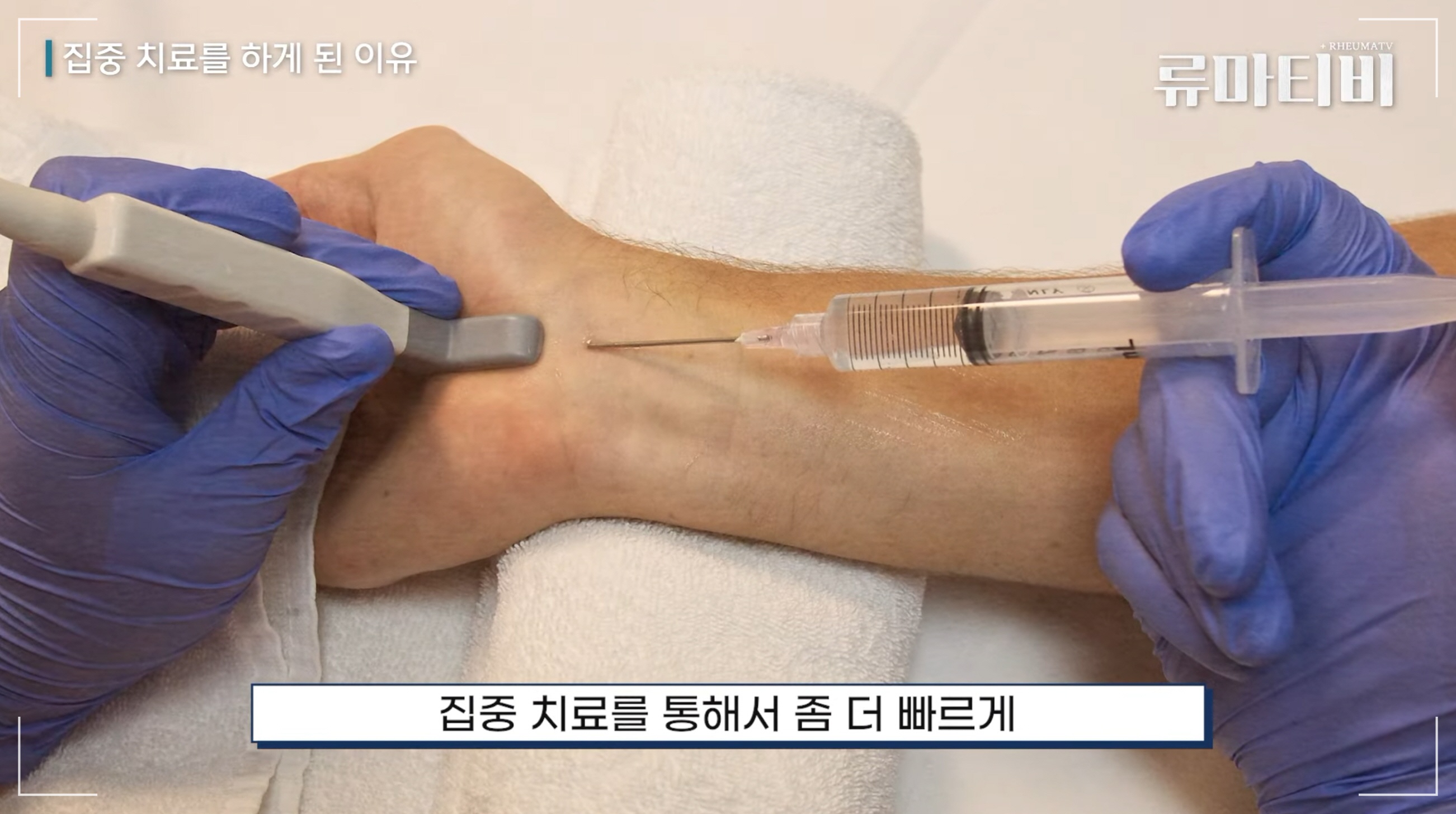 손가락 관절염 치료, 류마티스 치료 잘하는 곳은 관절 초음파 유도하 주사 치료를 비롯한 집중 치료를 진행합니다.
