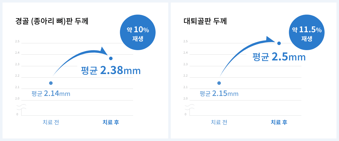 연골 재생 효과 기대