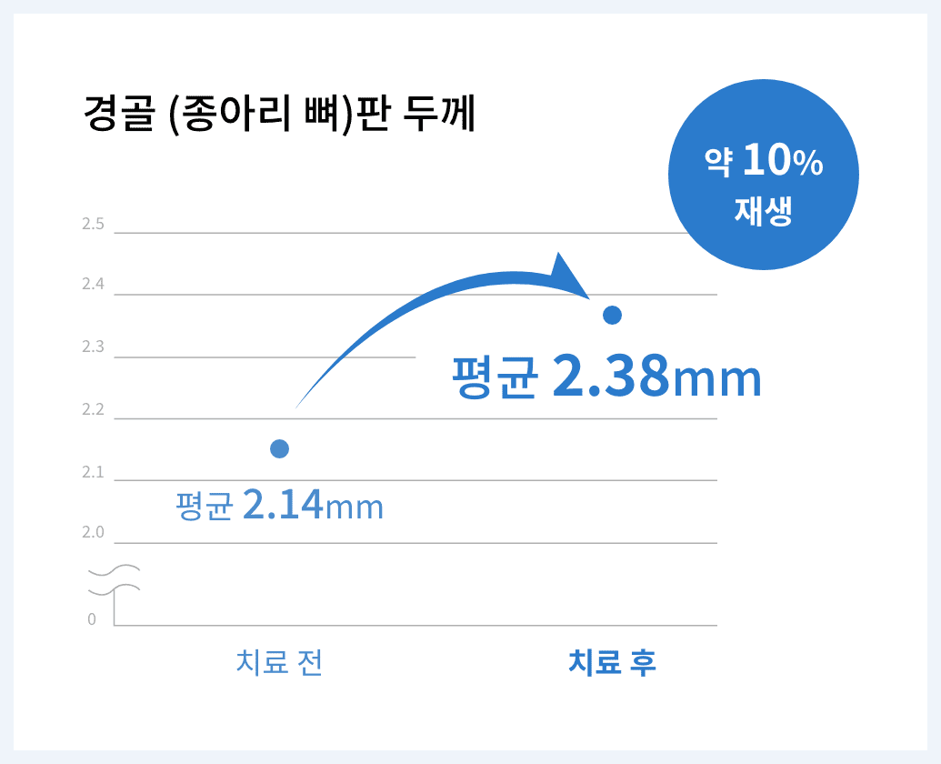 연골 재생 효과 기대