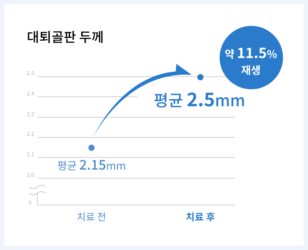 연골 재생 효과 기대